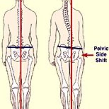 Fixed By KG - Tight muscles pull spine out of alignment...GET FIXED - Massage Therapy Near Me - Las Vegas, Nevada Fixed By KG - Tight muscles pull spine out of alignment...GET FIXED - Massage Therapy Near Me - Las Vegas, Nevada