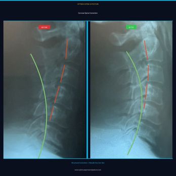 Optimus Spine & Posture - Chiropractors Near Me - Greensburg, Pennsylvania Optimus Spine & Posture - Chiropractors Near Me - Greensburg, Pennsylvania
