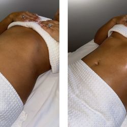 Skin Haven - Brazilian body sculpt with lymphatic drainage