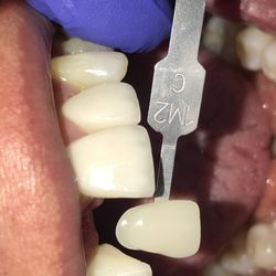 Central Valley Dentistry