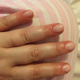 Cuticles swelled up and very itchy