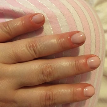 Nails For You - Cuticles swelled up and very itchy - Day Spas Near Me - Toronto, Ontario