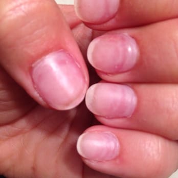 Myano Nails & Spa - Skin Care Near Me - Seattle, Washington Myano Nails & Spa - Skin Care Near Me - Seattle, Washington
