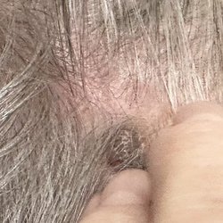 Ronnie N Dawood, MD - Sublime MD - My right side of side head.