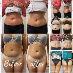 Bellebodybylinda - Clients results, more results on IG @bellebodybylinda