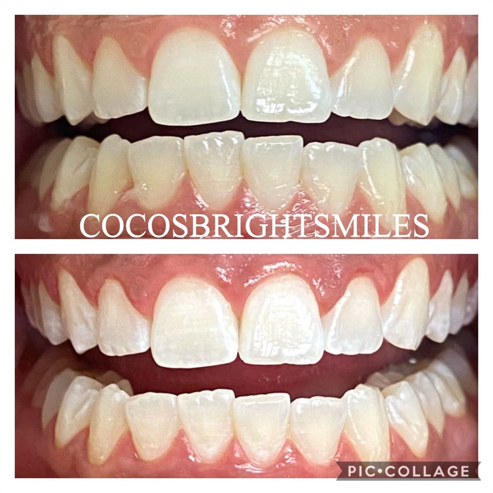 COCOS BRIGHT SMILES 13 Photos 1200 Woodruff Rd, Greenville, South
