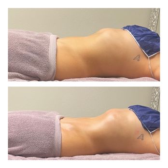 AZ Body Werx - 3n1 Method wood therapy - Body Contouring Near Me - Chandler, Arizona AZ Body Werx - 3n1 Method wood therapy - Body Contouring Near Me - Chandler, Arizona