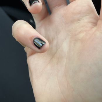 TipTop Nails Spa - Finger that had chunk taken off - Nail Salons Near Me - Spring Lake, North Carolina