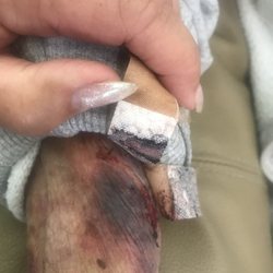 Bryant Ranch Guest Manors - Unexplained injury