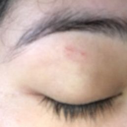 What it looks like now (5 days later) What it looks like now (5 days later)