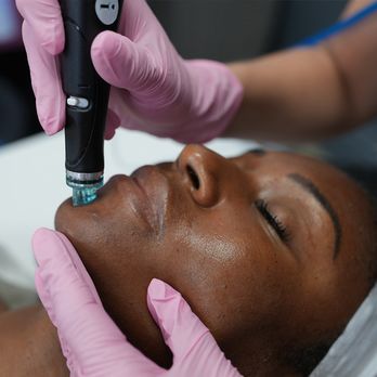 LaserAway - Tattoo Removal Near Me - Reston, Virginia