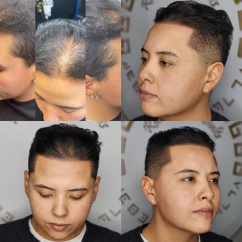 Real Time Results - Barber shop line up with full head density. Hugged up properly to her existing hairline. Making it less noticeable. - Hair Loss Centers Near Me - Boise, Idaho Real Time Results - Barber shop line up with full head density. Hugged up properly to her existing hairline. Making it less noticeable. - Hair Loss Centers Near Me - Boise, Idaho