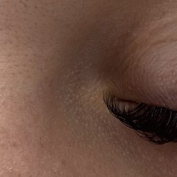Hybrid refill Hybrid refill