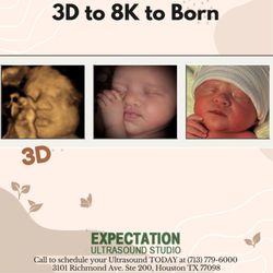 Expectation Ultrasound Studio - From ultrasound to unbelievable - 3D 8K real baby! Experience lifelike clarity and heartwarming moments you'll treasure forever