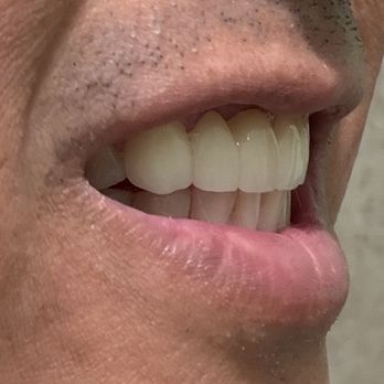 Cedar Smiles Dentistry - the new one side view - General Dentistry Near Me - Bellflower, California