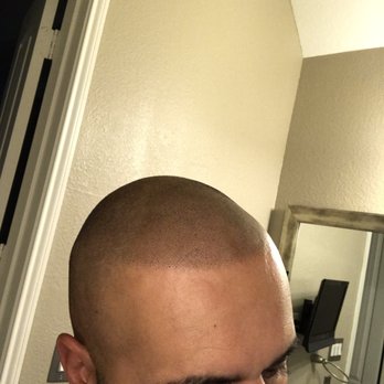 Scalpp Clinic - Hair Loss Centers Near Me - Houston, Texas Scalpp Clinic - Hair Loss Centers Near Me - Houston, Texas