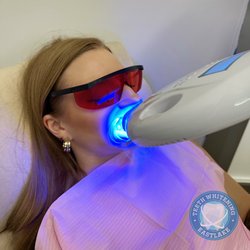 Teeth Whitening San Diego by Smile Studios - LED Teeth Whitening in progress at Eastlake Teeth Whitening in Chula Vista. The best Teeth Whitening Service in San Diego!