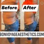 Photo of Bon Voyage Aesthetics & Body Sculpting