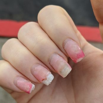 Hollywood Nails - Ouch! Bleeding and in pain during the removal process. - Nail Salons Near Me - Sacramento, California Hollywood Nails - Ouch! Bleeding and in pain during the removal process. - Nail Salons Near Me - Sacramento, California