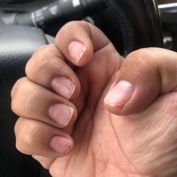 Posh Nails & Spa - Please someone tell me how you're suppose to get a manicure after they remove your acrylics and leave them like this... - Waxing Near Me - Riverside, California Posh Nails & Spa - Please someone tell me how you're suppose to get a manicure after they remove your acrylics and leave them like this... - Waxing Near Me - Riverside, California