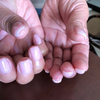 Crystal Nail Salon - Acrylic overlay was left underneath fingernails. - Nail Salons Near Me - Honolulu, Hawaii Crystal Nail Salon - Acrylic overlay was left underneath fingernails. - Nail Salons Near Me - Honolulu, Hawaii