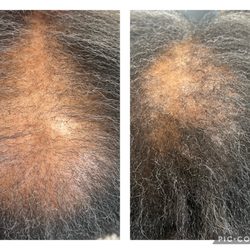 Lillian Te’ Laurie Hair Restoration