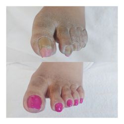 Heal ThyFeet Medical Pedicures