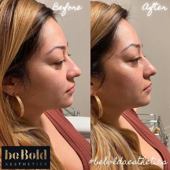 Bebold Aesthetics - Aestheticians Near Me - Rockville, Maryland Bebold Aesthetics - Aestheticians Near Me - Rockville, Maryland