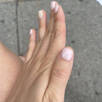 Sweet Sisters Nail & Spa - Gloppy thumb. Thicker gel on the medial edge, thinner application on the right edge. - Nail Salons Near Me - Bayside, New York Sweet Sisters Nail & Spa - Gloppy thumb. Thicker gel on the medial edge, thinner application on the right edge. - Nail Salons Near Me - Bayside, New York