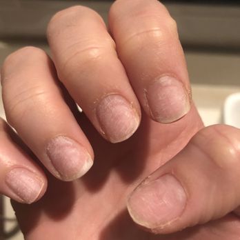 Apollo Nails & Spa - After dip removal - Nail Salons Near Me - Seattle, Washington