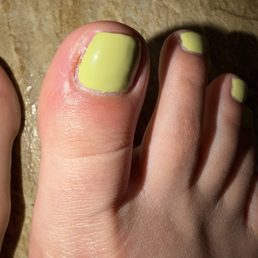 Cut deep on the sides of my nail bed, I can't even walk right now. #rip