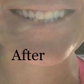 Sunshine Dental: Hung Chau, DDS - General Dentistry Near Me - Houston, Texas Sunshine Dental: Hung Chau, DDS - General Dentistry Near Me - Houston, Texas
