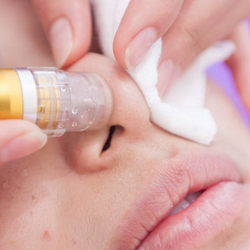 In Harmony Skin & Body Therapy - Aquafacial dermabrasion