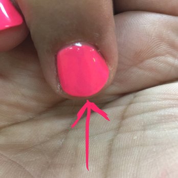 Pro Nails - Dark spots - Nail Salons Near Me - West Hartford, Connecticut Pro Nails - Dark spots - Nail Salons Near Me - West Hartford, Connecticut