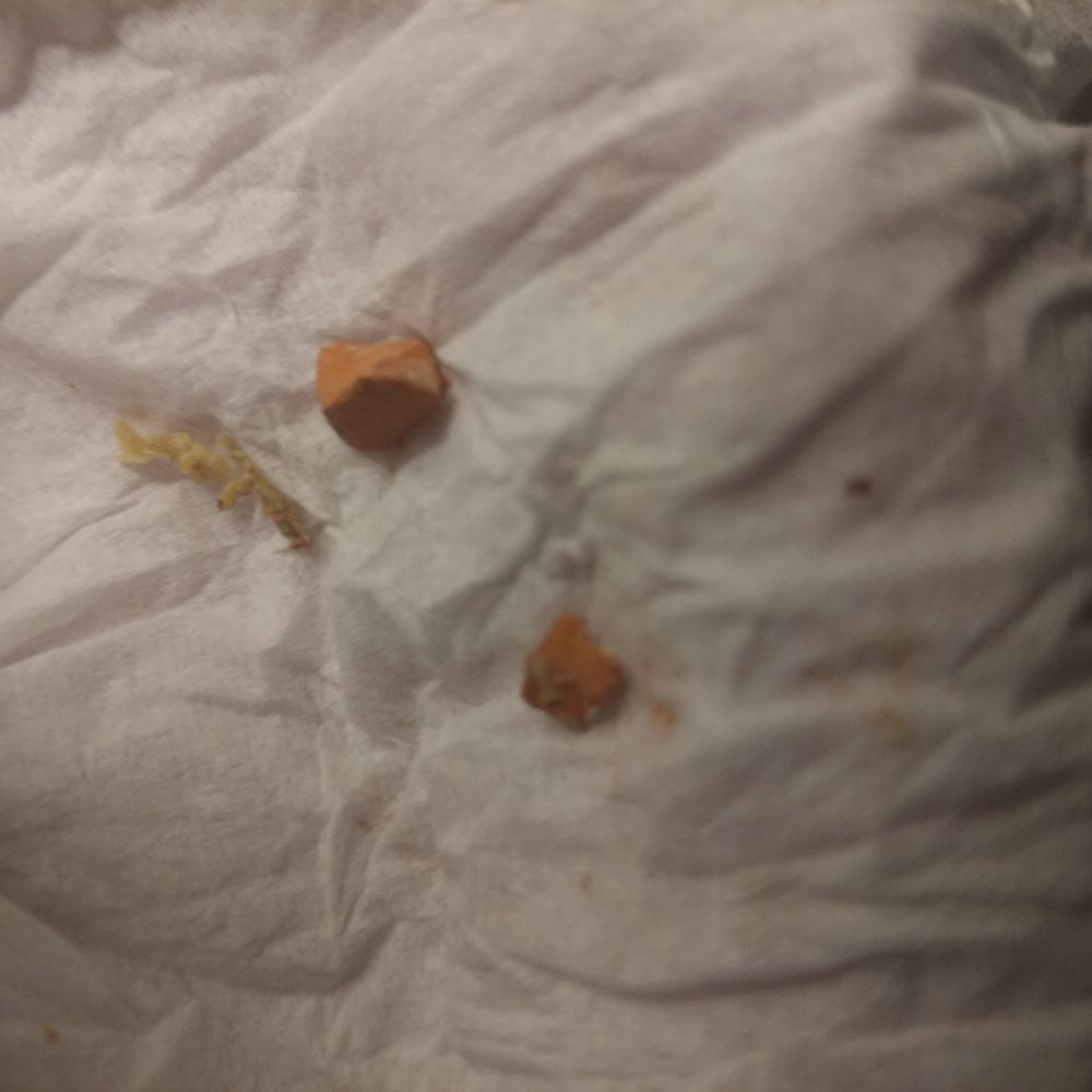 The brick that was in my food The brick that was in my food