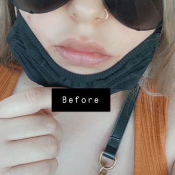 Before-N-After - Medical Spas Near Me - Menifee, California