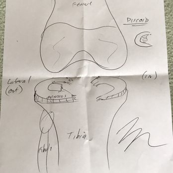 Bruce A Rolfe, MD - Dr. Rolfe's drawing of my knee - Sports Medicine Near Me - Kirkland, Washington