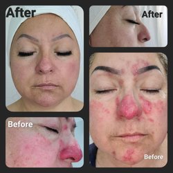 You can FEEL my pain through these photos.  These results are real. Book an appointment.
