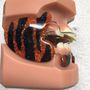 Photo of Orthodontic Custom Design
