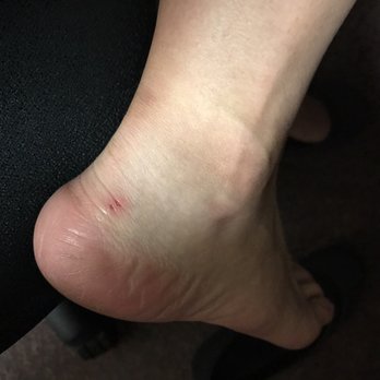 5th Ave Creative Nail - Cut on back heel from pedicure - Nail Salons Near Me - Brooklyn, New York