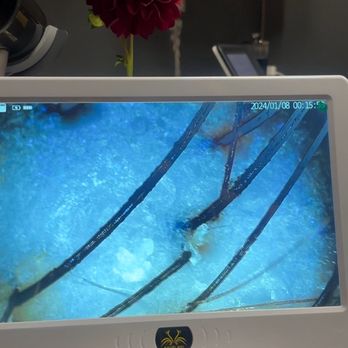 Head Spa EN - Before- Scalp analysis - Massage Near Me - Costa Mesa, California Head Spa EN - Before- Scalp analysis - Massage Near Me - Costa Mesa, California