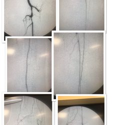 Vein & Fibroid Treatment Center - Great example of treating limb ischemia