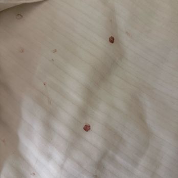 Silver Mountain Resort - Blood splatter in bed - Ski Resorts Near Me - Kellogg, Idaho Silver Mountain Resort - Blood splatter in bed - Ski Resorts Near Me - Kellogg, Idaho