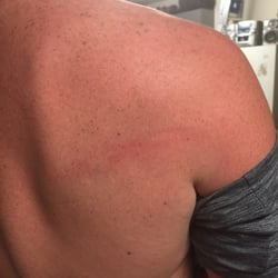 Heath's Canoe Rental - Assault from a cane by Johnny Heath!