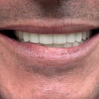 Sygma Dental - Prosthodontists Near Me - Montrose, California Sygma Dental - Prosthodontists Near Me - Montrose, California