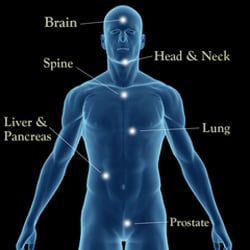 Anova Cancer Care
