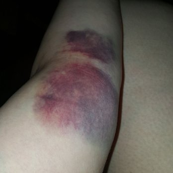 Impact Archery - String slap is no joke, man. 30 pound recurve. Arm guards. Seriously. - Archery Near Me - Las Vegas, Nevada
