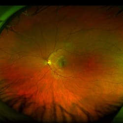 Woodinville Family Eyecare - Have you ever wanted the assurance of seeing your eye health in a photo? At Woodinville Family Eyecare, we are proud to provide Optos!