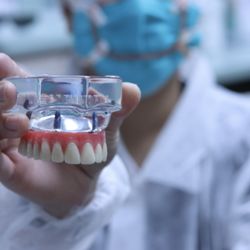 Lone Mountain Dental Las Vegas - Permanent dentures are an alternative to removable dentures for missing teeth. Unlike traditional dentures, permanent dentures are typically
