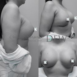 Cosmetic Surgery of DFW - Real patients, Real results, Real personalized Cosmetic Surgery of DFW
Dustin C Derrick, MD
Plastic & Reconstructive Surgeon
817.952.5340